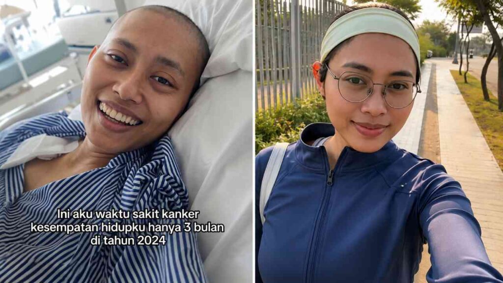 Kisah Naya Lawan Kanker Limfoma Stadium 4, Gejalanya Sempat Dikira Asam Lambung