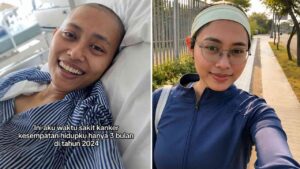 Kisah Naya Lawan Kanker Limfoma Stadium 4, Gejalanya Sempat Dikira Asam Lambung